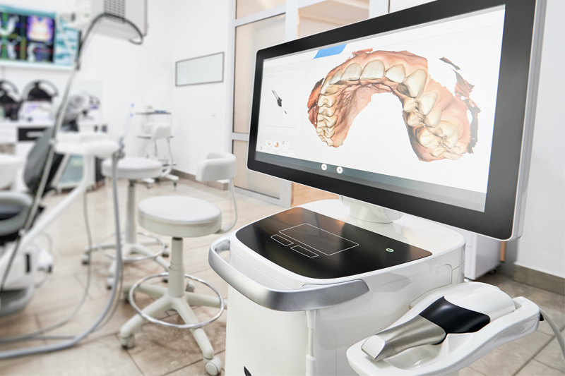 Intra-Oral Scanner in Aubrey
